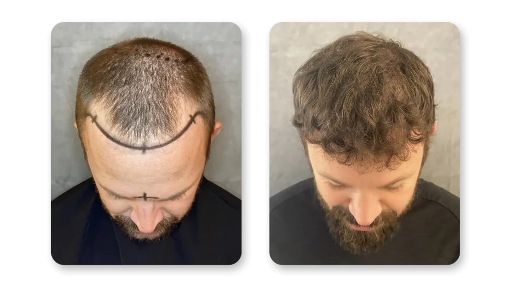 12-months-2.webp