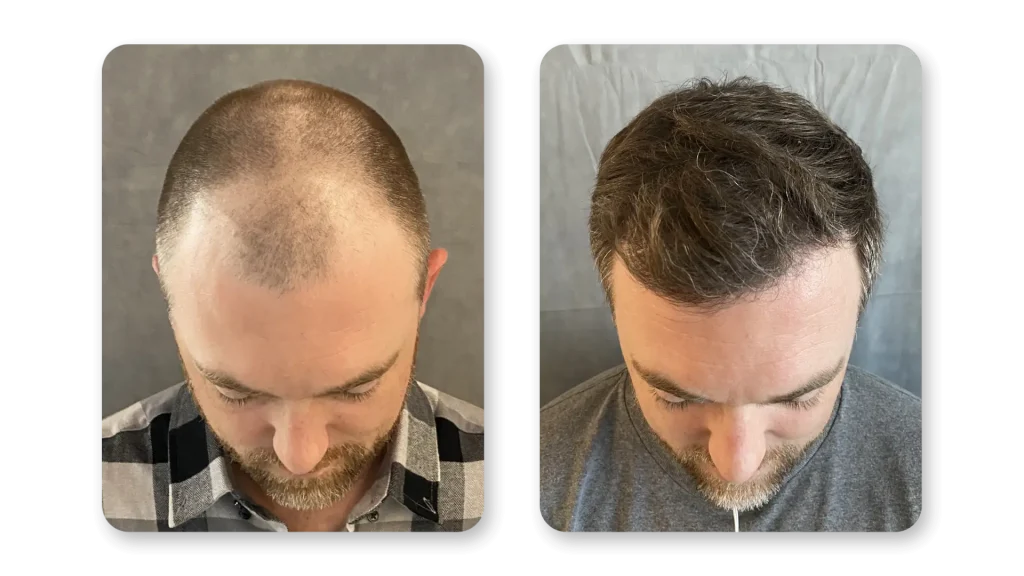 6-months-2-1.webp