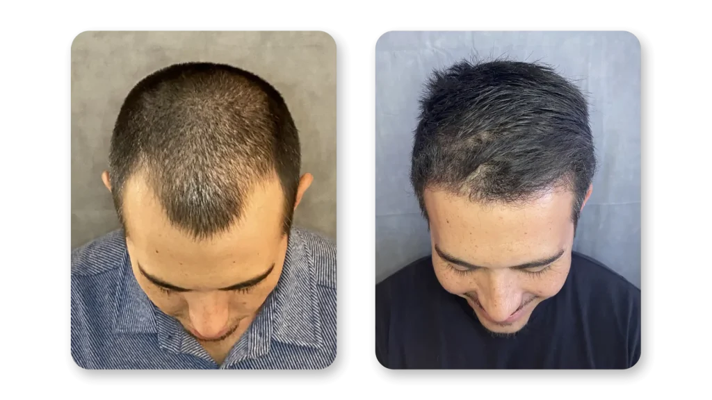 6-months-7.webp